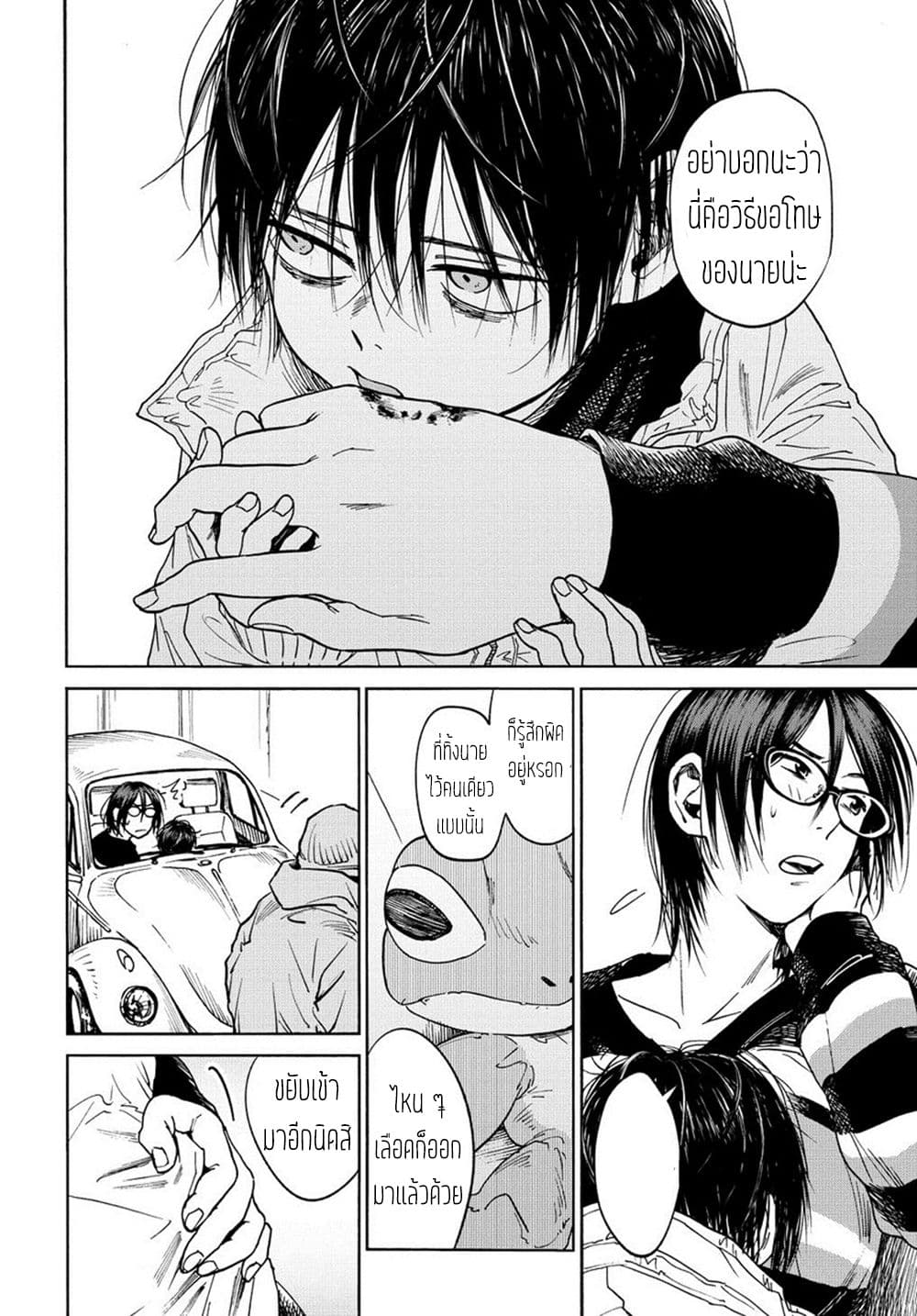 A Boy's Scar 2-2