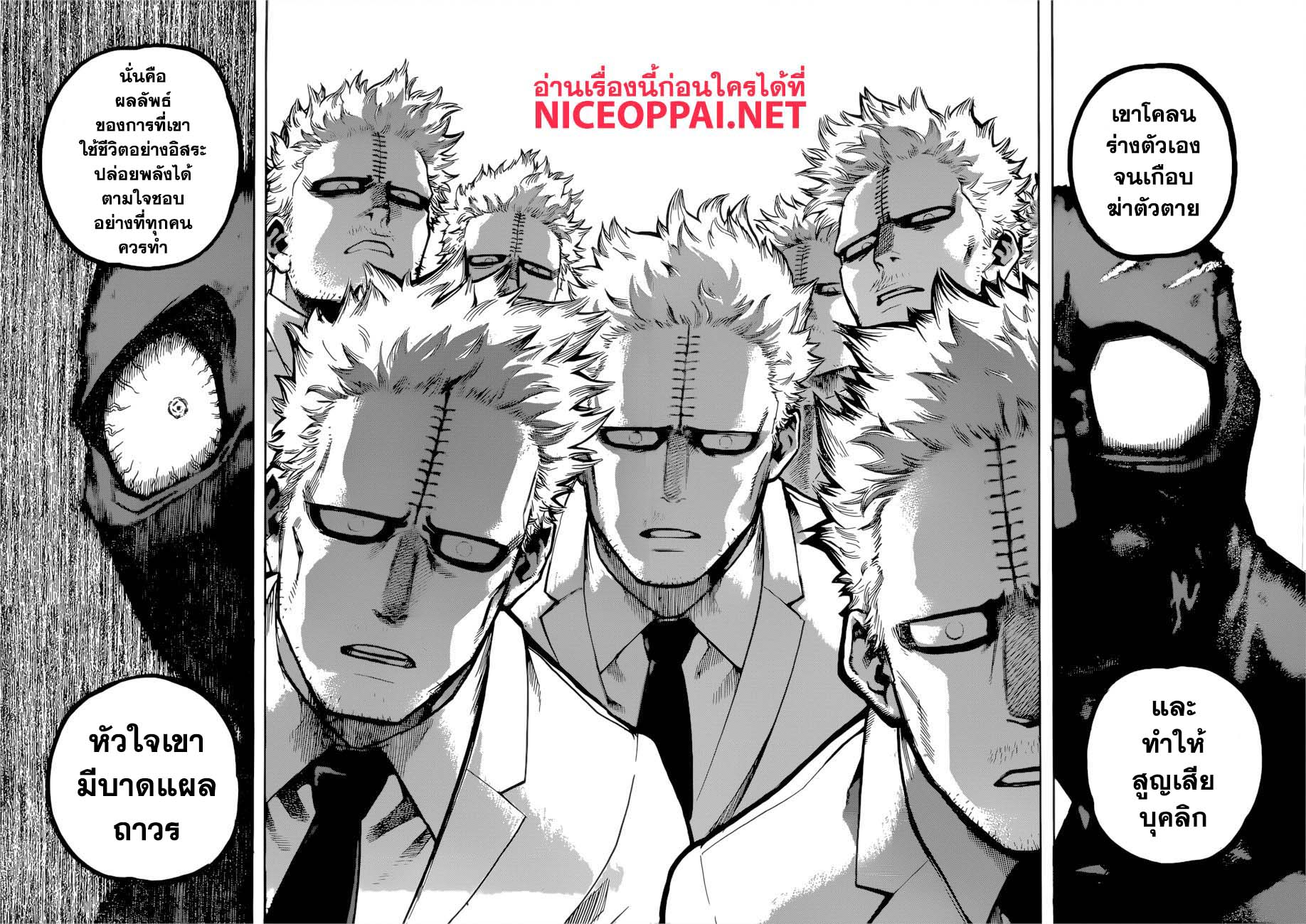 Boku no Hero Academia 228-หัวใจที่มีบาดแผล
