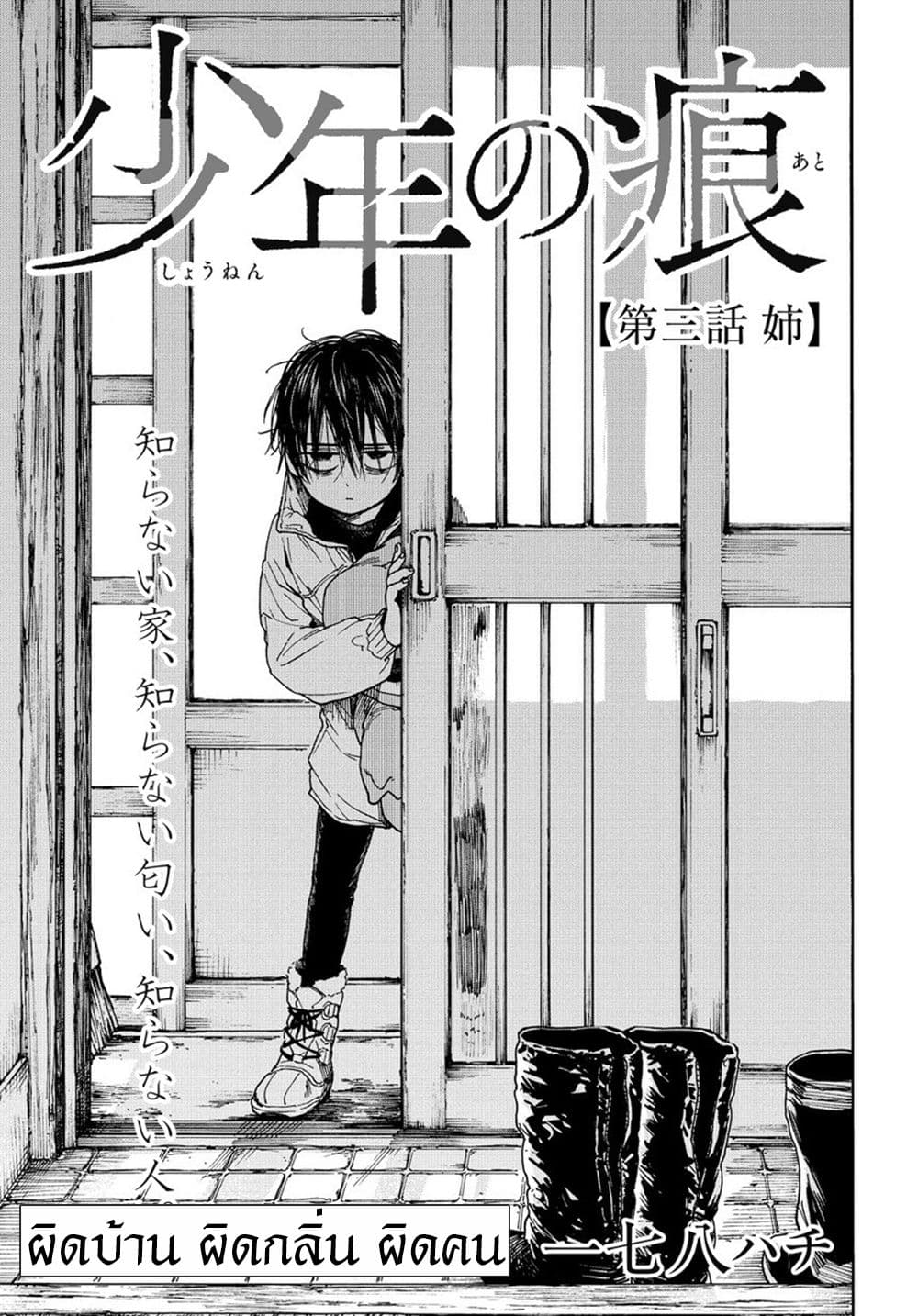 A Boy's Scar 3-3